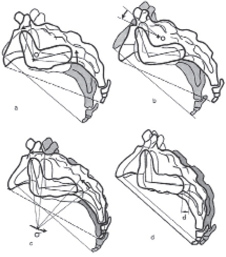 Figure 6. Different theories of the location of the axis of rotation. Alderink 1991. Reproduced with permission from CitationAlderink G J. The sacroiliac joint: review of anatomy, mechanics, and function. J Orthop Sports Phys Ther 1990; 13(2): 71-84. doi:10.2519/jospt.1991.13.2.71 Copyright © Journal of Orthopaedic & Sports Physical Therapy®.
