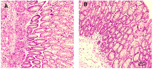 Figure 10 The morphology of rectal tissues after exposure to 5FU thermosensitive gel and TG-5FU-ME.