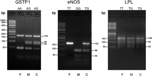 Figure 1.  Evaluation of the polymorphisms for the GSTP1, eNOS, and LPL genes, using a combination of PCR analysis, followed by restriction enzyme digestion and resolution of the digested PCR products by electrophoresis in 4% agarose gels. Representative trios (father, F; mother, M; and child, C) with their respective genotypes for each gene are shown. The size of the expected digested products, in base pairs (bp), is shown on the right of each panel. The first lane of each panel contains bands of the 50 bp DNA ladder, ranging from 50 to 1350 bp, used as molecular weight standards.