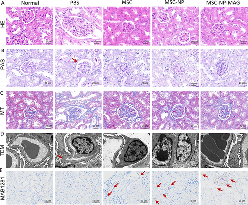 Figure 5 Histopathological Analysis of Tissues from Mice with Diabetic Nephropathy (DN). (A) Hematoxylin and Eosin (H&E) staining. (B) Periodic Acid-Schiff (PAS) staining. The red arrow indicates Bowman’s space. (C) Masson’s Trichrome staining. (D) Transmission Electron Microscopy (TEM) of renal tissues. The red arrow indicates thickening of the glomerular basement membrane. (E) Identification and distribution of Placental Mesenchymal Stem Cells (PL-MSCs) in the kidneys of mice with DN. The red arrow indicates MAB1281-positive cells in the kidney tissue.