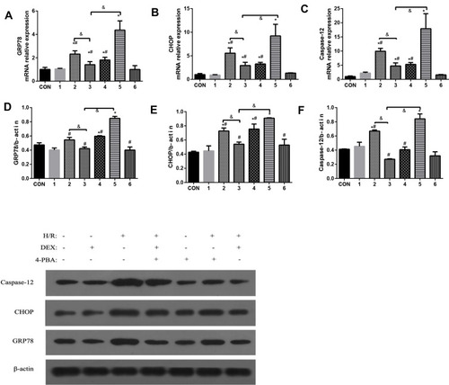 Figure 3 The effects of dexmedetomidine on the expression of GRP78, CHOP and caspase-12 in myocardial cells treated under different conditions were examined. (A–C) mRNA expression of GRP78, CHOP and caspase-12; (D–F) Protein expression of GRP78, CHOP and caspase-12. The results are expressed as the mean±SD. *P<0.05 vs the control group; #P<0.05 vs the H/R group; &P<0.05 vs the DEX+H/R group. Con, control group; 1, normoxic incubation with dexmedetomidine; 2, hypoxic/reoxygenation incubation with dexmedetomidine and 4-phenyl butyric acid; 3, hypoxic/reoxygenation incubation with dexmedetomidine; 4. hypoxic/reoxygenation incubation with 4-phenyl butyric acid; 5. hypoxic/reoxygenation incubation; 6. normoxic incubation with 4-phenyl butyric acid.