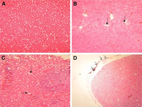 Figure 4 histopathological effects of GONs on the kidney of rats after 21 days. Representative photomicrograph of (A) control group (H&E, ×200), (B) Rats receiving 50 mg/kg of GONs (H&E, ×100); (C) rats receiving 150 mg/kg of GONs (H&E, ×100), and (D) Rats receiving 500 mg/kg of GONs (H&E, ×40).Notes: Black arrows indicate glomerular atrophy, a black dashed-arrow indicates interstitial nephritis, Black small arrows indicate capsular accumulation of GONs.Abbreviations: GONs, graphene oxide nanoplatelets; H&E, hematoxylin and eosin.