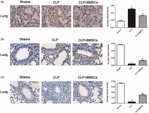 Figure 8. Treatment with BMSCs inhibited (A) TF, but increased (B) TM, and (C) EPCR expression levels in lung tissues after CLP-induced sepsis in mice. After 24 h of CLP surgery, lung samples were processed for immunohistochemistry analysis. Graphical representation of immunostaining for TF, TM, and EPCR expression levels evaluated in lung tissues is shown. Mean intensity of TF, TM, and EPCR staining were determined from image analysis, and are represented as optical density. Each column represents the mean ± SEM of four mice per group and represents three independent experiments; *p < 0.05 versus sham group; #p < 0.05 versus the CLP control group.