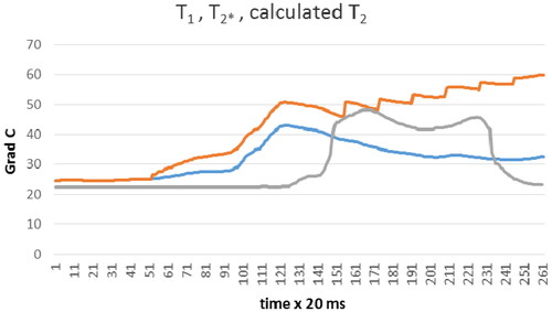 Figure 7. Т1 (Blue line), T2* (grey line), calculated T2 (orange line) during unicortical drilling as function of time.