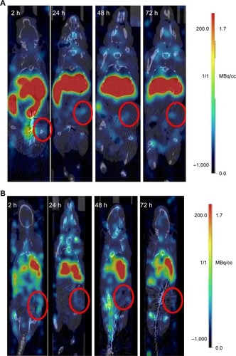 Figure 8 Positron-emission tomographs of representative animals at 2, 24, 48 and 72 hours post injection of (A) 89Zr-gemini surfactant and (B) 89Zr-lipoplex nanoparticles (LNP) tumor position was identified on the computed tompgraphic scan and red circles indicate the area of the tumor.