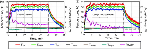 Figure 3. The experimental heating paradigm. (A) Hyperthermia curves measured from a 7 mm circular ROI centered on the acoustic focus of the transducer in a rabbit Vx2 receiving Caelyx and saline without microbubbles. (B) Hyperthermia curves measured in a rabbit Vx2 receiving Caelyx and microbubbles. Mean temperatures within the ROI are shown (green) as well as the temperatures that 90% (T90, blue) and 10% (T10, red) of the region exceeds. The fiber-optic temperature measurement of the rectum (brown) and the thigh muscle away from the focus (teal) are shown along with the ideal temperature response (black dashed line) and the acoustic power (purple).