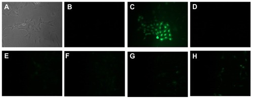 Figure 8 Images showing ROS detection on SH-SY5Y cells treated for 24 hours with increasing concentration of PLL-MNP. (A and B) are the bright field and the fluorescent images, respectively, of the negative control; (C) is the fluorescent image of the positive control (cell treated with TBHP); (D–H) are fluorescent images of cells incubated with 1, 5, 10, 20, and 50 μg/mL of PLL-MNPs, respectively.Abbreviations: PLL-MNP, poly-l-lysine-magnetic nanoparticle; TBHP, tert-butyl hydroperoxide.