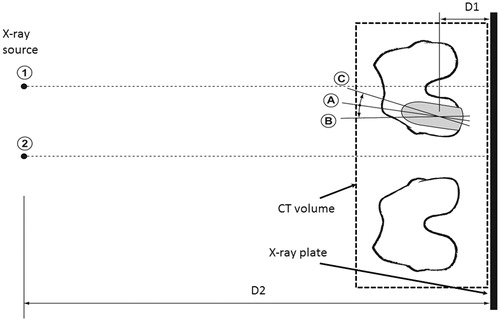 Figure 1. Schematic representation of the experimental setup. (1) and (2) shows the two positions of the X-ray source for the projection center at the center of the procedure knee and lying in between the two knees, respectively. D1 and D2 are the distances of the center of CT volume and X-ray source from the X-ray plate respectively. (A) (neutral), (B) (internal rotation), and (C) (external rotation) are the three different rotations applied to the femoral implant.