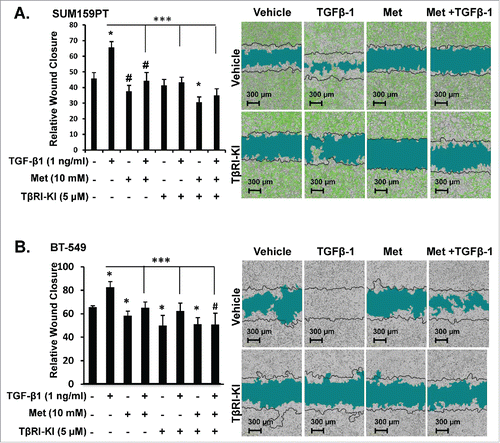 Figure 5. Metformin blocks TGF-β-mediated Motility in MSL/CL Cells. SUM159PT expressing ZsG-Luc and BT-549 parental cells were seeded in a monolayer prior to infliction of wound then treated with metformin (10 mM), TβRI-KI (5 µM), TGF-β1 (1 ng/ml), vehicle control or defined combinations. Cells were monitored for motility indicated by relative wound closure percentage for 6 days using IncuCyte Zoom™ in SUM159PT (A), BT-549 (B) cell lines. Representative images were taken at 24 hr time point, with black time indicating t = 0. Bar graph is represents relative wound closure at 24 hr time point for each cell line treated as indicated. Experiments were done n = 8 for each assay. Each assay was repeated at least three times for each cell line. Statistics were performed using a two-tailed t-test using excel and GraphPad Prism 6® to generate comparisons in bar graphs quantitation of relative wound closure (*P < 0.001 and #P < 0.01).