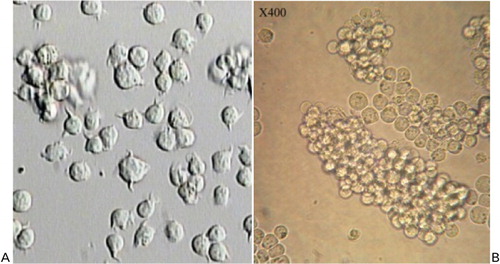 Figure 1. (A) Jurkat cells and (B) K562.