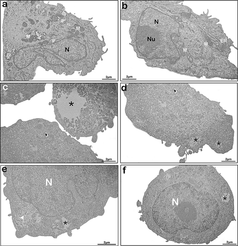 Figure 5 Ultrastructure changes in MDA-MB-231 cells treated with free-tarin. Ultrastructural images by transmission electron microscopy of untreated (a-b) and treated cells with free tarin at 72 μg/mL for 24 h (c-f). *cytoplasm extravasation; white arrow, enlargement and distension of endoplasmic reticula.