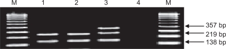 Figure 1a Agarore gel electrophoresis 1.5% stained with ethidium bromide showing the E-selectin DNA product after digestion with Pstl. Lanes M: DNA marker. Lanes 1, 2: AA allelic polymorphism. Lane 3: AC allelic polymorphism. Lane 4: negative control.