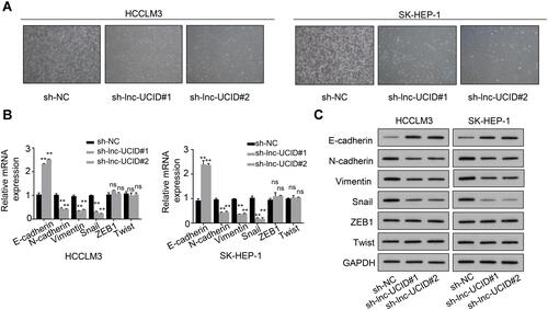 Figure 3 Lnc-UCID promotes the EMT process in HCC cells. (A) The effect of lnc-UCID on morphological changes in HCC cells was examined by microscopic observation. (B and C) The mRNA and protein expression levels of E-cadherin, N-cadherin, Vimentin, ZEB1, Snail and Twist were examined by qRT-PCR and Western blot assays, respectively. **P<0.01; ns, P>0.05, compared to sh-NC group.