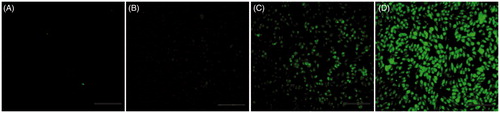 Figure 8. Gene expression on MDA-MB231 cells. The fluorescence images of GFP expression were taken 48 h post-infection with hPAMAM–PEGDGA/DNA in the different concentrations: (A) No treated, (B) 2 μm, (C) 4 μm, (D) 8 μm. Magnification: 100×. Results were performed as fluorescent microscopy images.