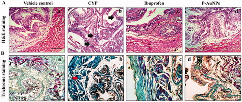 Figure 8. Effect of P-AuNPs on microscopic changes induced with CYP administration (A) Representative microphotographs of (a) vehicle control, (b) CYP-treated group, (c) ibuprofen (100 mg/kg), and (d) P-AuNPs (1 mg/kg) shown by H&E-stained bladder tissue section observed at 100× magnification. (B) Representative photomicrographs of Masson’s trichrome stained bladder tissue in (a) vehicle control, (b) CYP-treated group, (c) ibuprofen (100 mg/kg), and (d) P-AuNPs (1 mg/kg) groups observed at 100× magnification. Black arrow represents haemorrhage, inflammation, and ulceration. Red arrow indicates blue-stained collagen and smooth muscles are red-counterstained.