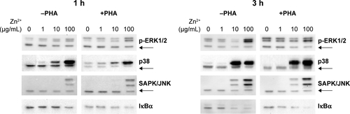 Figure S4 Activation of ERK (1,2), p38, SAPK/JNK, and IκBα induced by the Zn2+ ions in Jurkat cells.Note: The Zn2+ ions were tested at three different concentrations (1, 10, and 100 μg/mL), and in the presence of absence of PHA.Abbreviations: ERK, extracellular signal-regulated kinase; h, hour; IκBα, nuclear factor kappa-light-chain-enhancer of the activated B-cell inhibitor; JNK, c-Jun amino-terminal kinase; Nps, nanoparticles; PHA, phytohemagluttinin; SAPK, stress-activated protein kinase.