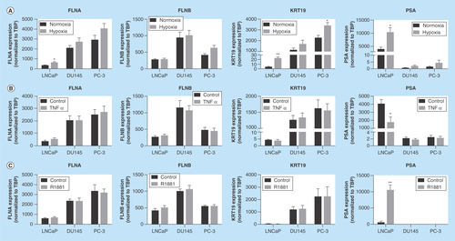 Figure 2.  Regulation of biomarkers by prostate cancer-relevant stimuli in vitro.Cells were exposed to hypoxia (1% oxygen; A), TNFα (10 ng/ml; B) or R1881 (1 nM; C) for 24 h. Expression was assessed by quantitative RT-PCR and normalized to TBP. Data represent means ± SEM, N = 3. * p < 0.05 and ** p < 0.01 compared with normoxia or control. FLNA: Filamin-A; FLNB: Filamin-B; KRT19: Keratin-19; RT-PCR: Real-time PCR; SEM: Standard error of the mean; TBP: TATA-binding protein.