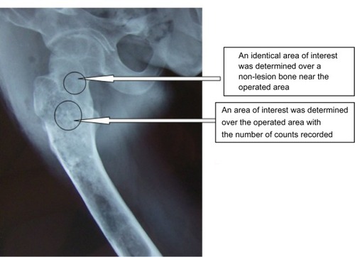 Figure 2 Determination of the grafting-to-non-lesion count ratio (G/N ratio).