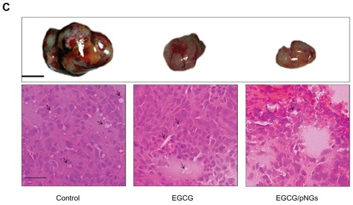 Figure 6 Growth inhibition effects of EGCG and in combination with pNG in a murine MBT-2 subcutaneous tumor model: (A) tumor-volume ratio in the mice was detected individually following treatment by feeding 2 mg/mouse EGCG or 2 mg/mouse EGCG-pNG (23:2.5) via an oral route (ig) and intaperitonially (ip); (B) tumor-volume double time indicating tumor volumes in mice receiving the different drugs (control, EGCG, and EGCG-pNG) at day 29; (C) photographs and histology (H&E staining, 40×) of excised tumors from mice. Pictures of tumors show engorgement of tumor vessels in the control group that are larger than the EGCG and EGCG-pNG groups. The H&E-staining histology of the tumor mass shows more vessels in the cross-sectional view in the control compared to the other groups.Notes: Black line, 1 cm; black arrows, tumor vessels; scale bar, 25 μm.Abbreviations: EGCG, epigallocatechin-3-gallate; H&E, hematoxylin and eosin; pNG, physical nanogold.
