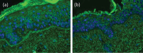 Figure 8. Indirect immunofluorescence on type VII collagen-deficient skin. Indirect immunofluorescence microscopy of a EBA patient’s serum on normal human skin shows linear labeling of IgG at the basement membrane zone (a), while on type VII collagen-deficient skin, no staining is seen (b; courtesy of Dr. Hendri Pas, Department of Dermatology, University of Groningen, The Netherlands).