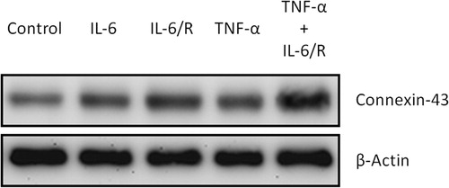 Figure 1. Upregulation of connexin-43 in tumorigenic C6 glioma cells by IL-6, IL-6/sIL-6R and TNF-α/IL-6/sIL-6R. Western blots of glioma cells were carried out after cytokine treatment.