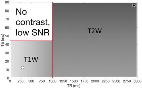 Figure 4 Relaxometric map for MR imaging of FH at different TE and TR. White-gray area indicates positive contrast relative to water, darker gray indicates negative contrast. The black and white circles indicate the parameters used to obtain. Figures 5 and 6Abbreviations: MR, magnetic resonance; TE, echo time; TR, repetition time; SNR, signal-to-noise ratio; T1W, T1 weighted; T2W, T2 weighted.