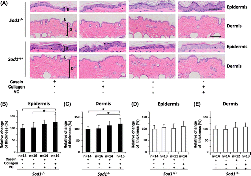 Fig. 1. Co-treatment with CP and the VC derivative additively thickened the epidermal and dermal layers in the hairless Sod1−/− mice.Notes: (A) Hematoxylin and eosin staining of the back skin of hairless Sod1−/− and Sod1+/+ mice treated with the casein peptide (casein), CP (collagen), casein peptide plus the VC derivative (VC) and CP plus the VC derivative. Casein peptide or CP was orally administered, while the VC derivative was transdermally applied on the skin once a day for eight weeks. E, epidermis; D, dermis. The scale bar represents 50 μm (top) and 200 μm (bottom). The thickness of the epidermis (B) and dermis (C) of the back skin of the hairless Sod1−/− mice. The thickness of the epidermis (D) and dermis (E) of the back skin of the hairless Sod1+/+ mice. The data indicate the mean ± SD; *p < 0.05.