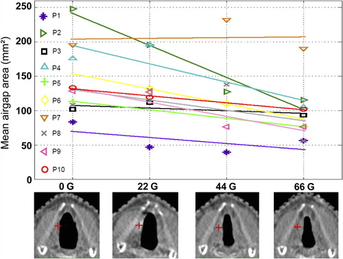 Figure 5. Upper panel: For each patient, the airgap area between the vocal cords, averaged over the various breathing phases (various axial CT-slices), as a function of delivered dose is presented. The lines are results of regression analyses, with on average, a statistically significant negative slope (see text). Lower panel: axial CT slices for patient 2 at the level of the iso-center (indicated by a red +) for doses 0 Gy, 22 Gy, 44 Gy, and 66 Gy.