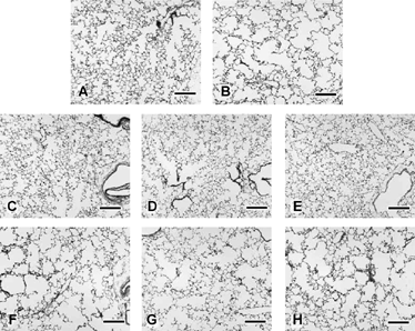 Figure 7 Left lung parenchyma from male A/J mice after 15 weeks of filtered air (A, C–E) or cigarette smoke exposure (B, F–G) followed by either no treatment (A, B), sham-treatment by nose-only inhalation exposure to ethanol vehicle (C, F), nose-only exposure to low-level ATRA (3,600 mg-minutes/m3; D, G), or nose-only exposure to high level ATRA (18,000 mg-minutes/m3; E, H). Note moderate irregular alveolar air space expansion in all cigarette smoke-exposed mice without any reversal of the lesion by the 3-week ATRA treatment. Emphysema is qualitatively similar in lungs from cigarette smoke-exposed mice treated with ATRA by i.p. injection (not shown). Bars = 200 µm.