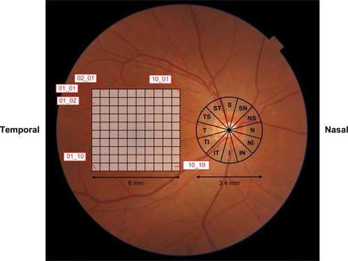 Figure 1 An example of the location pattern of 10×10 grids in the 6×6 mm analysis area and 3.4 mm diameter circle centered on the disc.