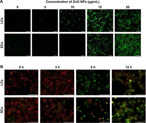 Figure 6 Evaluation of ROS level and mitochondrial membrane potential in LCs and SCs after ZnO NP treatment.Notes: (A) Intracellular ROS levels were measured with fluorescence imaging using the DCFH-DA probe in cells cultured in the presence of increasing concentration of ZnO NPs for 6 hours. Scale bars =100 μm. (B) Mitochondrial membrane potential (ΔΨm) was evaluated using JC-1 in cells treated with 15 μg/mL ZnO NPs for 0, 3, 6, and 12 hours. Red fluorescence indicates JC-1 aggregates within the mitochondria in healthy cells, whereas green fluorescence indicates JC-1 monomers in the cytoplasm and loss of Δψm. Scale bars =100 μm.Abbreviations: DCFH-DA, dichloro-dihydro-fluorescein diacetate; LCs, Leydig cells; NPs, nanoparticles; ROS, reactive oxygen species; SCs, Sertoli cells; h, hours.