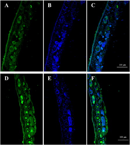 Figure 7. Coumarin 6 percutaneous penetration of the skin by laser confocal microscopy (Blank (A) Coumarin 6; (B) DAPI; (C) Coumarin 6 + DAPI; MNs (D) Coumarin 6; (E) DAPI; (F) Coumarin 6 + DAPI).