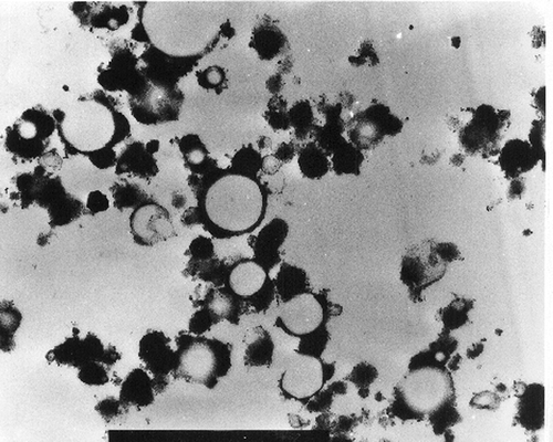 Figure 5 TEM micrograph of calf rennet milk coagulum (30,000×).