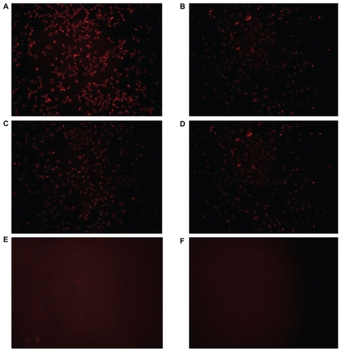 Figure 9 Fluorescence microscopy of cellular uptake of (A) trastuzumab-decorated chitosan-doxorubicin conjugated nanoparticles by SKOV-3 cell line, (B) trastuzumab-decorated chitosan-doxorubicin conjugated nanoparticles by MCF-7 cell line, (C) chitosan-doxorubicin conjugated nanoparticles by SKOV-3 cell line, and (D) chitosan-doxorubicin conjugated nanoparticles by MCF-7 cell line. (E) SKOV-3 cells and (F) MCF-7 cells in cell culture medium served as negative controls.