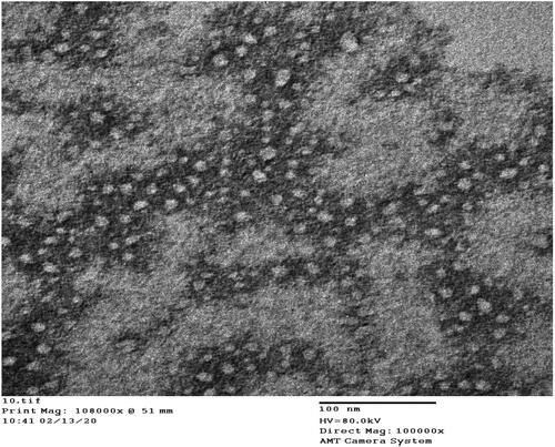 Figure 2. Negative stain electron micrograph of formula LNC15 at a magnification of ×100,000.