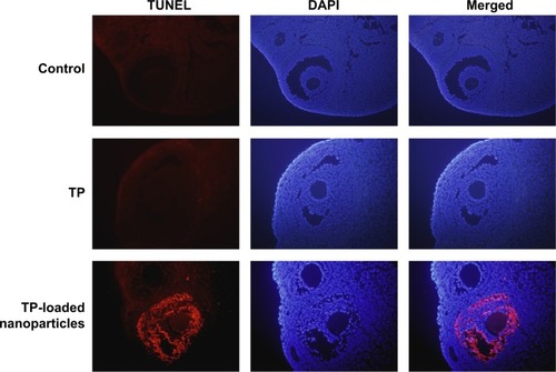 Figure 7 Detection of follicle cell apoptosis by TUNEL assay (×400).Abbreviations: TUNEL, terminal deoxynucleotidyl transferase dUTP nick end labeling; DAPI, 4′,6-diamidino-2-phenylindole; TP, triptolide.