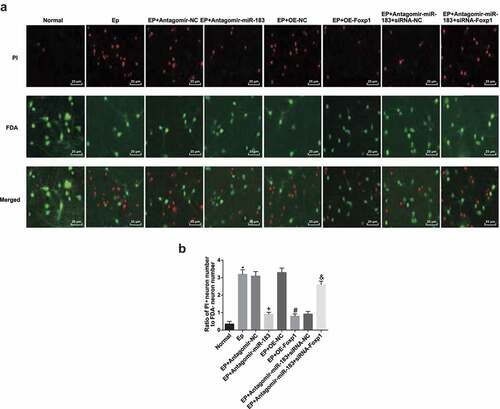 Figure 4. Inhibited miR-183 and overexpressed Foxp1 restrict neuron apoptosis in hippocampus of EP rats. (a), representative images of FDA/PI staining (400 ×); (b), statistical results of ratio of apoptotic neurons and survival neurons after the rats’ hippocampal tissues conducted with FDA/PI staining. * P < 0.05 vs the normal group, + P < 0.05 vs the EP + Antagomir-NC group, # P < 0.05 vs the EP + oe-NC group, & P < 0.05 vs the EP + Antagomir-miR-183 + siRNA-NC group. N = 5, the measurement data conforming to the normal distribution were performed as mean ± standard deviation, one-way ANOVA was employed for comparisons among multiple groups, and Tukey’s post hoc test was used for pairwise comparisons after one-way ANOVA