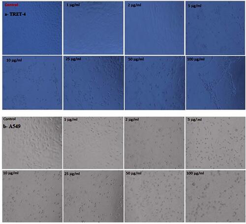 Figure 10 Morphological alterations in (A) TERT4 cell line and (B) A 549 cell lines exposed to AME-AgNPs at 1–100 mg/mL for 24 h. Images were taken using phase contrast inverted microscope at 20x magnification.