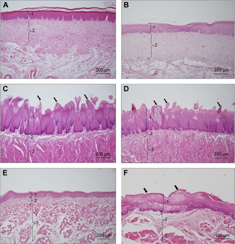 Figure 7 Images of histological examination.Notes: (A) Palatal mucosa of a cured animal (1: epithelium, 2: lamina propria) (HE ×10). (B) Palatal mucosa of an animal with ongoing infection (1: epithelium, 2: lamina propria) (HE ×10). (C) Tongue mucosa of a cured animal (HE ×10) (1: epithelium, 2: lamina propria, 3: muscle, [→] papillae of the tongue). (D) Tongue mucosa of an animal with ongoing infection (HE ×10) (1: epithelium, 2: lamina propria, 3: muscle, [→] papillae of the tongue). (E) Buccal mucosa of a cured animal (HE ×10) (1: epithelium, 2: lamina propria, 3: muscle). (F) Buccal mucosa of an animal with ongoing infection (HE ×10) (1: epithelium, 2: lamina propria, 3: muscle, [→] degradation in the stratified epithelium).Abbreviation: HE, hematoxylin–eosin.