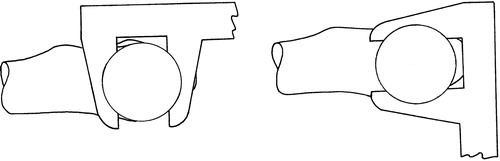 Figure 3. Caliper tool position for AP line (left) and PD lines (right).