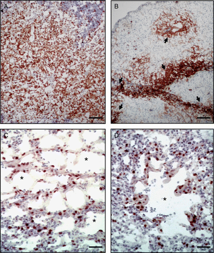 Figure 1.  Immunohistochemical demonstration of replication of the RM1 strain in the thymus and lung at 6 and 14 d.p.i. 1a: Expression of pp38 antigen in the thymus of a chicken 6 days after subcutaneous (s.c.) vaccination with 10,000 PFU of RM1. Bar = 120 µm. 1b: Expression of pp38 antigen in the thymus of a chicken 14 d.p.i. with 10,000 PFU of RM1 by the s.c. route. Bar = 120 µm. Please note that the thymic tissue has marked depletion of lymphocytes and the pp38 expression is limited to the remnant lymphoid tissues. Arrowheads show the islets of positive cells. 1c: Expression of pp38 antigen in the lung of a chicken 6 d.p.i. with 10,000 PFU of RM1 by the s.c. route. Bar = 40 µm. Please note the distribution of positive cells in the parabronchi (asterisks) and within the interstitium. 1d: Expression of pp38 antigen in the lung of a chicken 6 d.p.i. with 10,000 PFU of RM1 by the s.c. route. Parabronchi are indicated with asterisks. Bar = 60 µm.