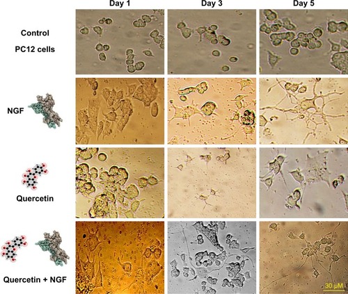 Figure 5 Typical images of differentiated PC12 cells at 1, 3, and 5 days after treatment with NGF (50 ng/mL) and quercetin (10 µM) and NGF + quercetin. Quercetin induces PC12 cell differentiation (magnification: 200×).Abbreviation: NGF, nerve growth factor.