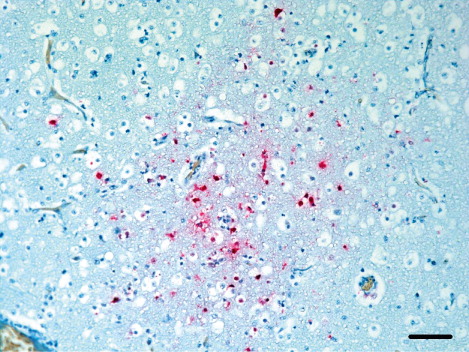 Figure 7. Micrograph of the brain from a meat-type duck showing viral antigens detected in the neurons, glial cells and mononuclear cells around the blood vessels. Biotin–streptavidin complex with haematoxylin counterstain. Scale bar: 50 µm.