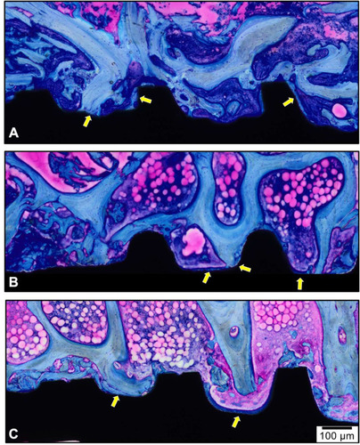Figure 6 Representative photomicrographs of wound healing to different implant surfaces 14 days after implantation. (A) HAnano®, (B) SLActive®, and (C) TiUnite®. Observe the three most coronally situated implant’s threads that were located in the cancellous bone. The yellow arrows represent regions of bone-implant contact. Stain: Toluidine Blue and Acid Fuchsin stained. Magnification: 20×; Scale bar: 100µm.