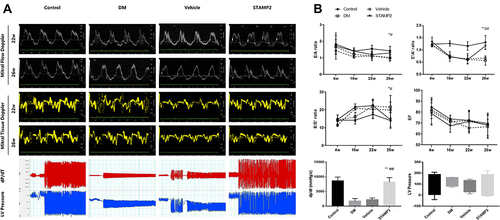 Figure 6 STAMP2 attenuates diabetes-induced diastolic dysfunction. (A): Representative mitral flow Doppler, tissue Doppler, dP/dT and LV pressure results for rats in the control, DM, vehicle and STAMP2 groups; 6 samples from each group were used for the study. (B): Analysis of the E/A, E’/A’, and E/E’ ratios; EF; dp/dt; and LVEDP in control, DM, vehicle and STAMP2 rats. The data are shown as t-test results for each group. *p<0.05 vs vehicle, **p<0.01 vs vehicle, #p<0.05 vs DM, ##p<0.01 vs DM.
