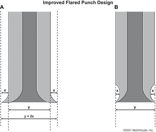 Figure 3 The diameter of an ordinarily flared punch (A) is broader than that of the all-purpose punch forged from the same outer-diameter punch and flared by coring the concavity of the first 1–2 mm of the tip (B).
