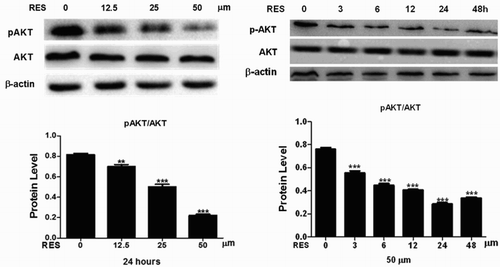Figure 4. Roles of resveratrol in the phosphorylation of Akt in prostate cancer cells. Western blot analysis of the expression of p-Akt and Akt in the cells. Statistical significance was assessed by one-way ANOVA.