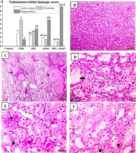 Figure 3. Histopathological examination of the kidney tissues with H&E. (A) The score of tubulointerstitial damage. Microscopic pictures of kidney specimens showing: (B) normal glomerular and tubular kidney structure (normal group, 100×), (C) protein leakage in the tubular lumen (CKD group, 100×), (D) mild interstitial collagen proliferation (bold black arrow) and prominent nuclei (white arrow) (SPL group, 400×), (E) mild congestion (star), mitotic figure (arrowhead) and prominent nuclei (white arrow) (ZnO-NPs group, 400×) and (F) prominent nuclei (white arrow) and mitotic figure (arrowhead) (SPL + ZnO-NPs group, 400×). a: significant difference versus control, b: significant versus CKD, c: significant versus SPL, d: significant versus ZnO-NPs at p < 0.05.