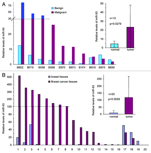 Figure 1. Expression of miR-93 in human breast carcinoma specimens. (A) RNAs were isolated from paraffin blocks of human breast carcinoma specimens and the benign breast tissues, followed by real-time PCR analysis of miR-93 levels. The breast carcinoma tissues expressed significantly higher levels of miR-93 than the benign tissues. (B) RNAs were isolated from paraffin blocks of human breast carcinoma specimens with lymph-positive (metastasis) and the benign breast tissues followed by analysis of miR-93 levels. The tumor tissues expressed significantly higher levels of miR-93.