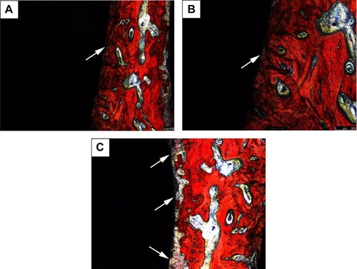 Figure 6 Van Gieson’s staining images of polished cross-sections of the implants in bone of different groups after 2-month implantation.Notes: (A) Experimental group, (B) positive control group, and (C) blank control group. The arrows show the fibrous connective tissue.